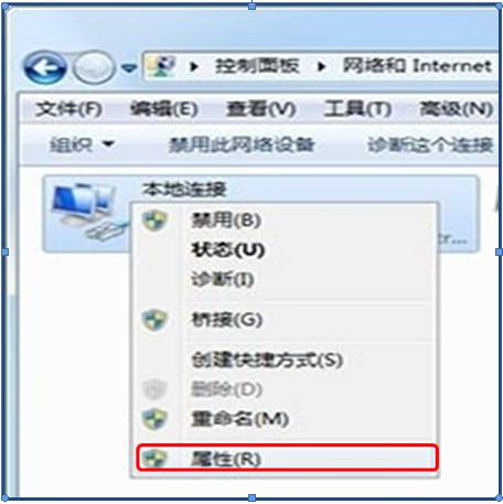 右击“本地连接”图标弹出的快捷菜单